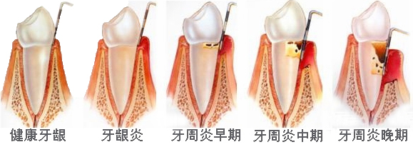 1521534727165715.jpg 201604201540135650.jpg