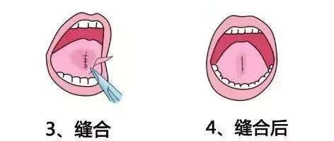 1710811598413836.png 640 (1).png